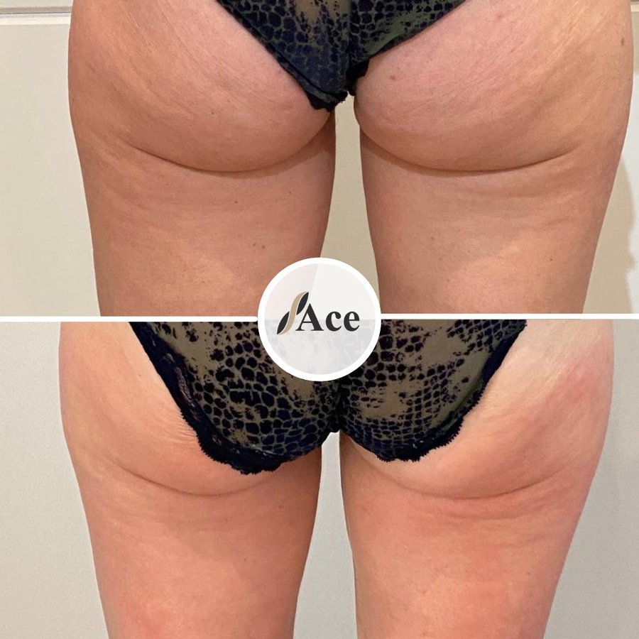 Ace Aesthetics - Ace Aesthetics